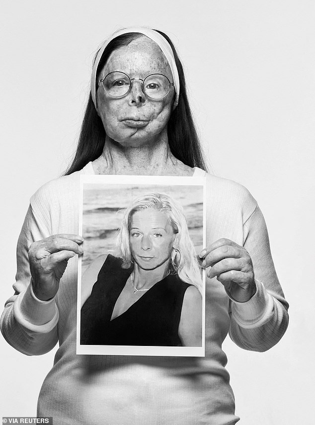 Patrcia Lefranc, 59, from Belgium, was shot by famed British fashion photographer Rankin for a campaign launched to highlight the horrific impact of acid attacks on survivors.  Depicted with an image of herself from before the attack, the photo suggests she is still mourning her former appearance