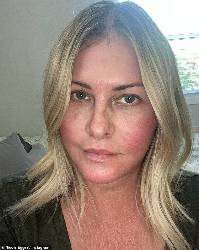 Nicole Eggert has seen her famous friends rally behind her cause as she raises money for her battle against stage two breast cancer