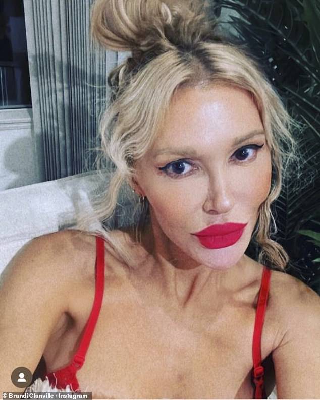 Brandi Glanville has revealed that her face is swollen due to stress caused by claims she inappropriately touched Caroline Manzo while filming Real Housewives Ultimate Girls Trip