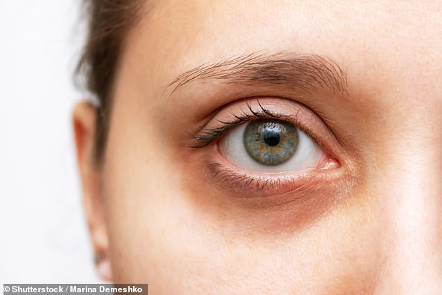 Dark circles are very common as we age, but there are products that can make them appear less visible, say dermatologists