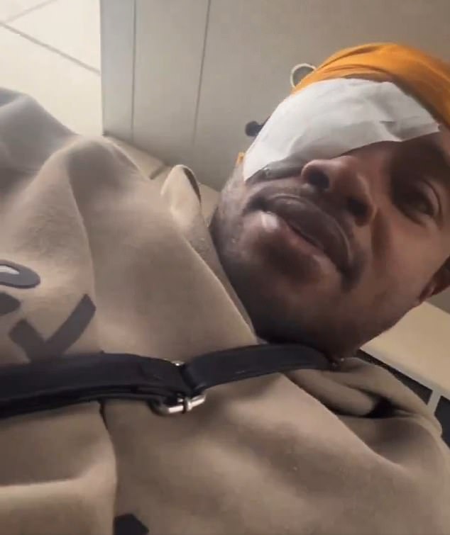 Errol Spence Jr has undergone cataract surgery after claiming he went into his superfight against Terence Crawford last year with an eye injury