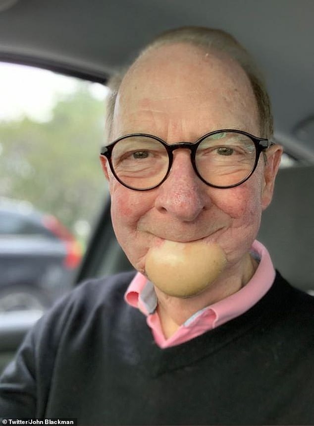 John Blackman (pictured) underwent a massive 12-hour operation in 2018 to remove a cancerous tumor from his mouth and jaw