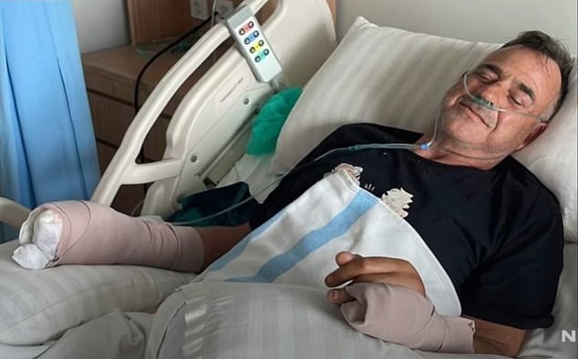 Nick Gilbert, 58, originally from the Adelaide Hills but now living in Bali, is fighting to hold on to his hands after a fireworks accident on New Year's Day left them 'unrecognizable'