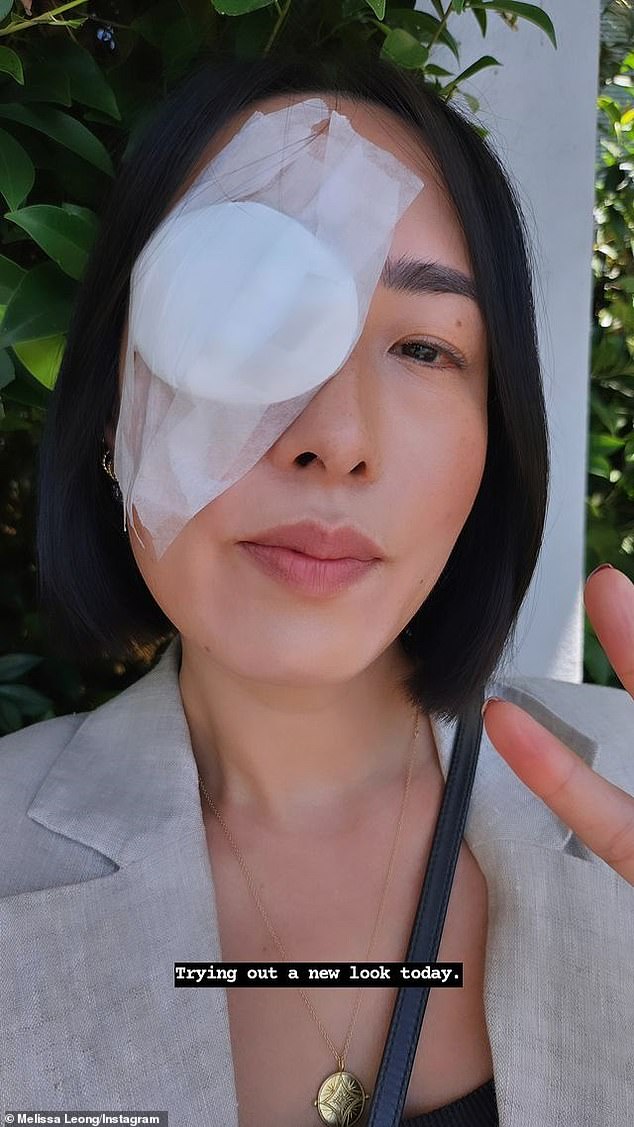 Melissa Leong (photo) has undergone unexpected eye surgery.  The former MasterChef star shared images on Instagram of her eye being bandaged following a procedure to repair a chalazion.  A chalazion is an inflammatory lesion of the eyelid