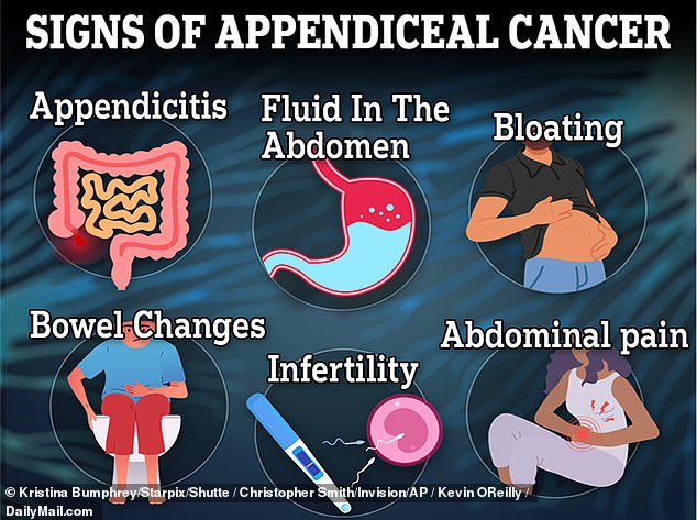 The above image shows the symptoms of appendix cancer.  Doctors discover a mysterious increase in the number of cases of the disease