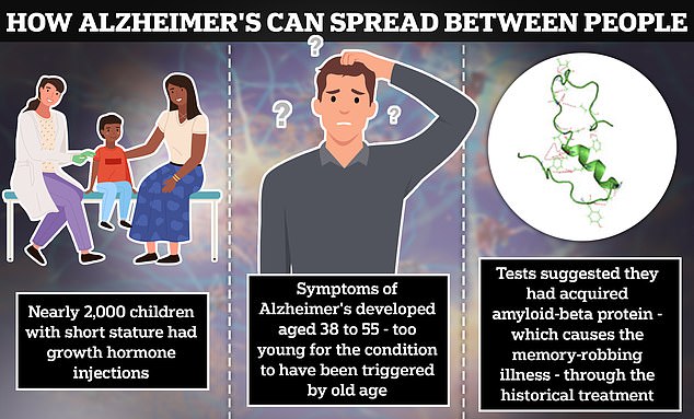 Five patients were among 1,848 injected as children with growth hormones infected with toxic 'seeds' of amyloid beta protein.  All five suffered from the same rare early form of the devastating dementia.  Others who received the same treatment are now considered 'high risk'