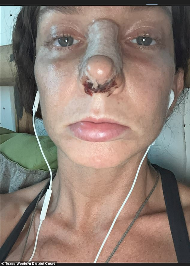 Armstrong fled Texas after shooting star Moriah Wilson and underwent plastic surgery in Costa Rica, including a nose job, which she shows off in newly available images