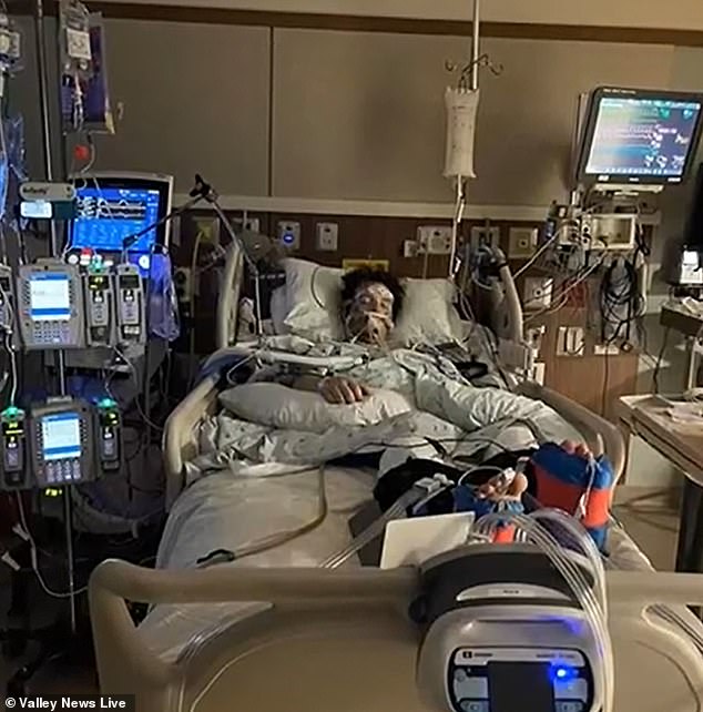 The young adult was intubated to give his lungs a chance to heal, but his condition continued to worsen and doctors were forced to place him on an ECMO machine.