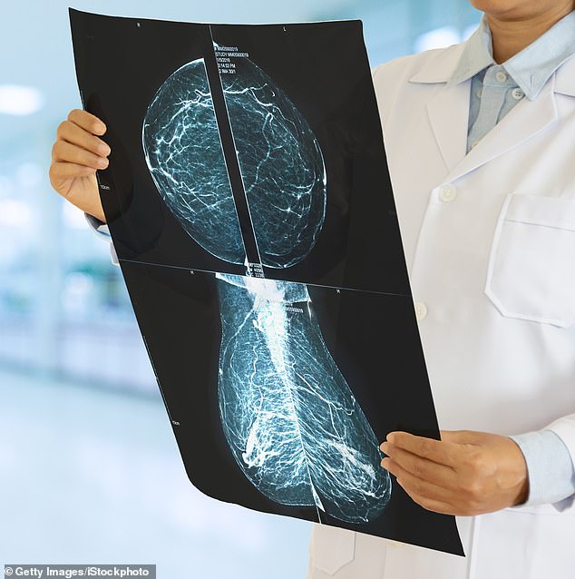 By 2024, the total cost of breast cancer to the economy is estimated at £2.6 billion to £2.8 billion