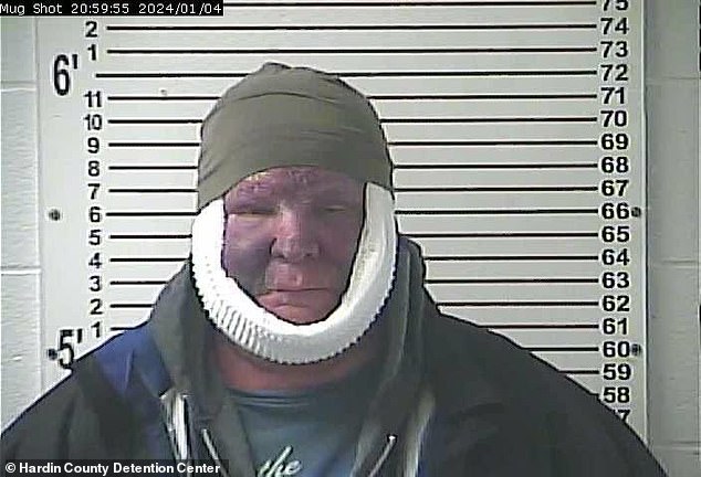 David Love appeared badly bruised in his mugshot after his arrest on child abuse charges.  It is not clear how he suffered the injuries