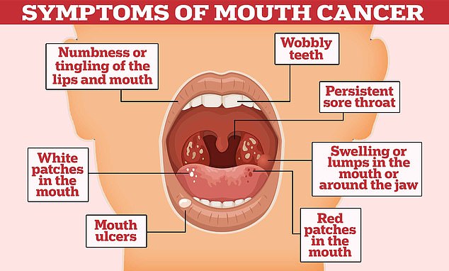 One of the best ways to detect oral cancer early is to perform self-exams at home.  Checking your mouth for sores and wobbly teeth can help detect cancer early