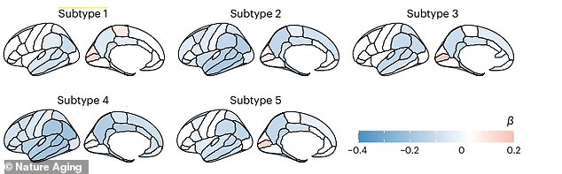 This graph shows the brain areas that shrunk in each Alzheimer's disease subtype in the study compared to healthy controls.  Blue areas indicate shrinkage, with the deeper shades representing more extreme withdrawal, while pink areas indicate areas of greater thickness