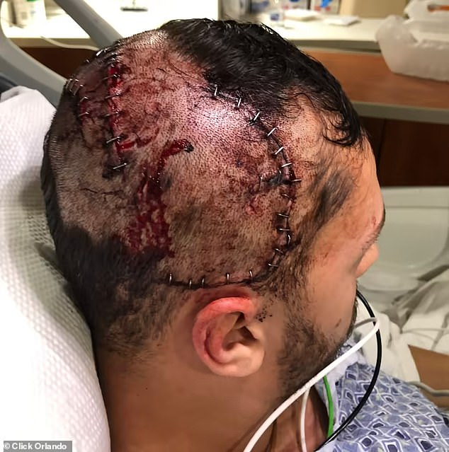 Heim received 34 staples to his head after the attack, but he credited a GoPro on his head with saving his life, saying that if he hadn't been wearing the camera 