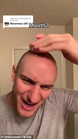 Twitch star Zeph Sanders started losing his hair at age 20 and wore a beanie to disguise his balding