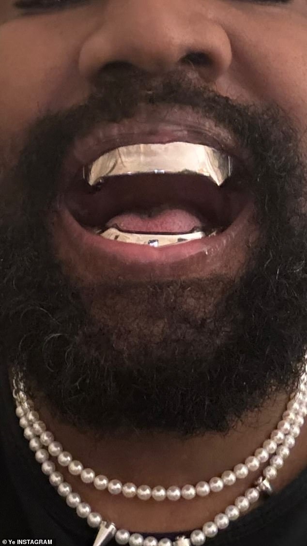 The 46-year-old rapper shocked fans on Wednesday after debuting a set of Bond villain-esque titanium dentures on Instagram