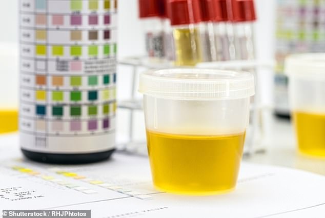 Urobilin gives urine its classic color.  Doctors have known this for a long time, but they did not know which enzyme was responsible for the formation of urobilin