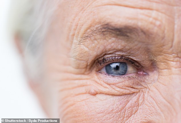 Exposure to ultraviolet light and the aging process are known factors that can cause the skin to lose its youthful elasticity.  But now researchers think bacteria may also play a role, as wrinkly women were found to have more types of bacteria on their faces