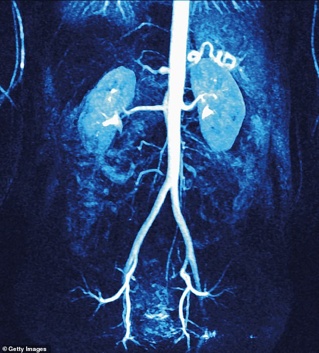 Pembrolizumab looks set to become the standard treatment given to patients after surgery after a trial showed a huge increase in survival rates