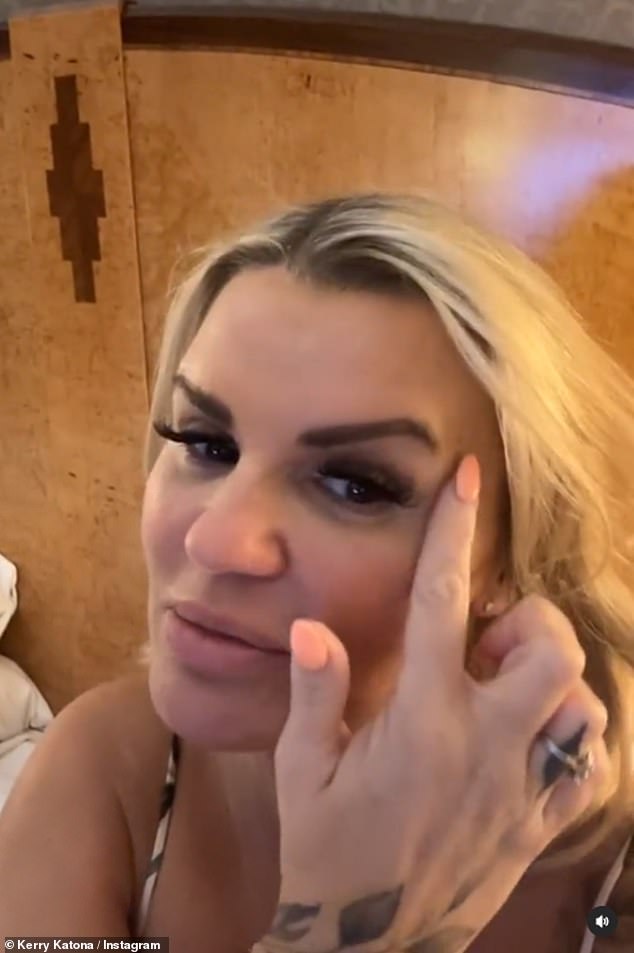 Kerry Katona showed off the results of her cosmetic eyelid surgery and brow lift - a procedure called blepharoplasty, which involves removing excess skin from the eyelids