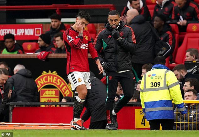 The Argentinian looked visibly disappointed after having to leave the field with the injury