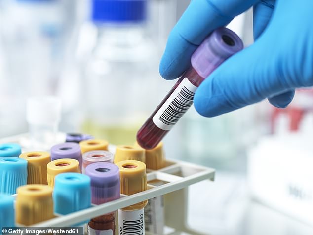 In my experience, a blood test as simple as a preoperative complete blood count, for example, has more than once revealed more serious disease prior to surgery for a completely unrelated condition (stock image)