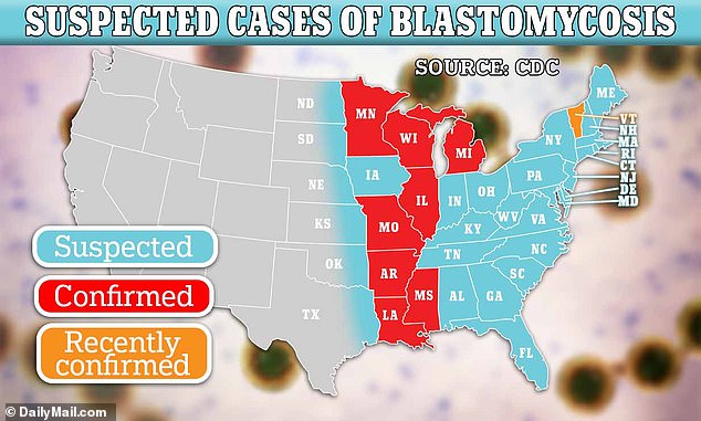 The map above shows states where cases of blastomycosis are confirmed (red), recently confirmed (orange), or suspected (blue)