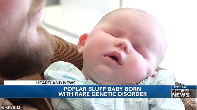 Wrenley has a haploinsufficiency of the PRR-12 gene, which prevented her eyes from developing in the womb