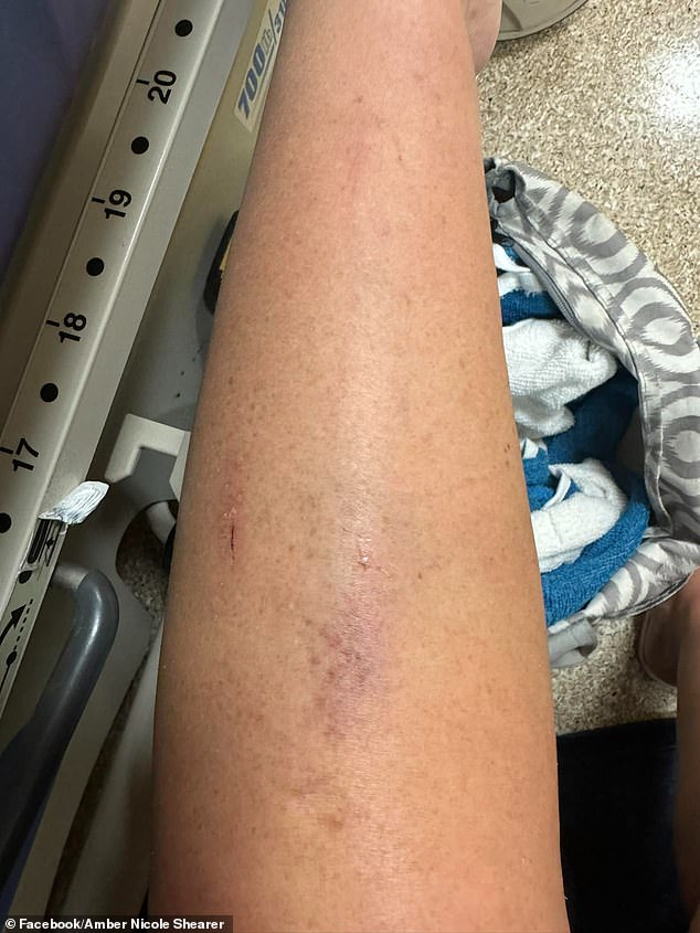 The women say they were handed drinks laced with drugs at the Pirate's Cove resort.  They started feeling strange and said that when they woke up they were covered in cuts and bruises