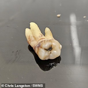 He pulled out his own tooth (pictured) because he couldn't get an NHS appointment.  An appointment with a private dentist would have cost Mr Langston £40 for a check-up and up to £50 for removal, which he could not afford