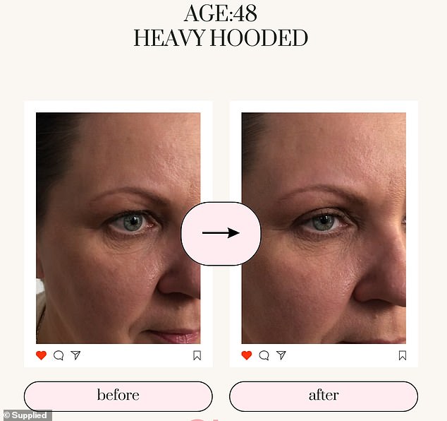 The innovative eyelid product combines the benefits of eyelid tape and eyelid glue