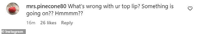 One fan said: 'What's wrong with your upper lip?  Something is going on??  Hmmmm??'  while a separate Twitter user asked: 'What is that bump in the middle of his upper lip?'