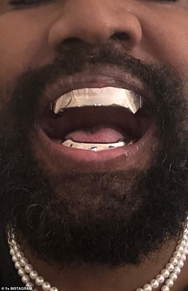 A few weeks ago, Kanye showed off his new metallic smile in an Instagram post, comparing his look to the iconic James Bond villain Jaws.  Yet sources close to the star say the 46-year-old hasn't actually 'replaced' his teeth and that his striking titanium grin is just an elaborate dental prosthetic.