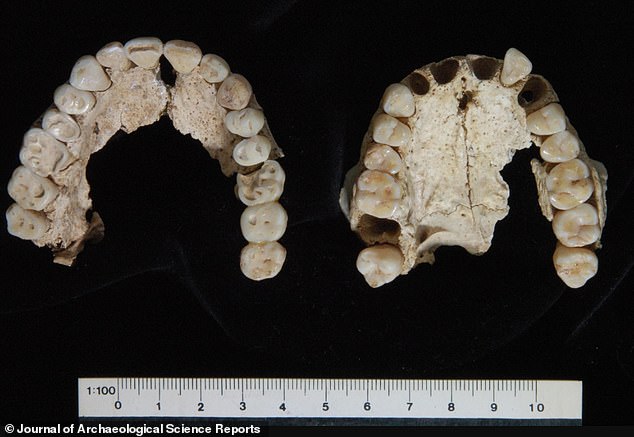 Teeth from Grave I: The left is a 'robust middle-aged adult male' and the right is a young adult female.  Tomb I also contains the remains of a woman and a baby, which researchers believe are Philip II's wife Cleopatra and their newborn child.