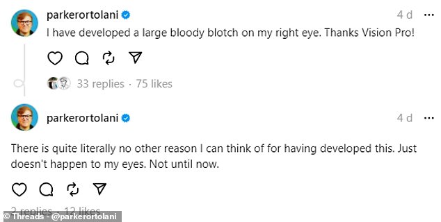 Continuing on Threads, Mr Ortolani blamed the headset for a burst blood vessel.  'I have developed a large bloody spot on my right eye.  Thank you Vision Pro,” he wrote.  “I literally can't think of any other reason why I developed this.  It just doesn't happen to my eyes.  Not until now'