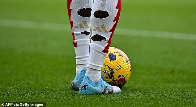 Bukayo Saka shows off the hole cut in his socks, which reduces pressure on the calf muscle