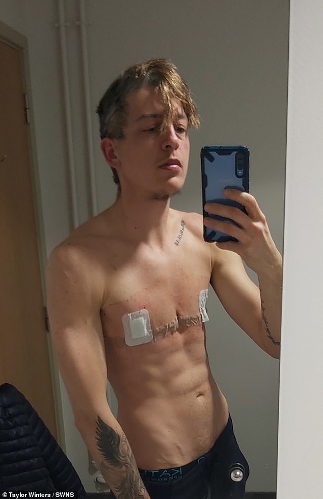 Taylor after top surgery in October 2019