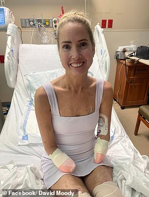 She was eventually diagnosed with double pneumonia, which led to sepsis.  She had to have her arms amputated below the elbow and legs above the knee