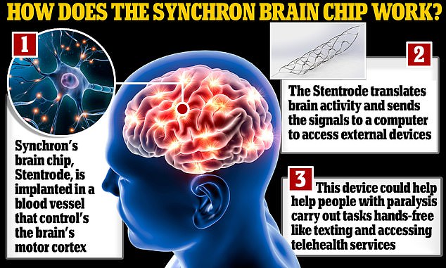 The Stentrode works by identifying what each electrical signature is and acts as a dictionary to decipher the person's intent so they can perform the function.