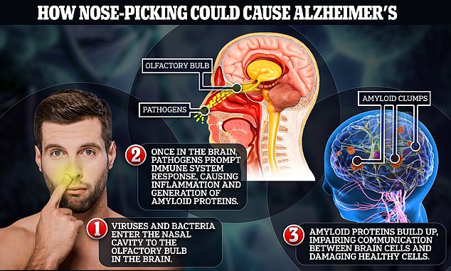 The memory-robbing disease is characterized by a buildup of harmful protein deposits in the brain, known as amyloid beta.  When the brain becomes inflamed, it expresses an amyloid precursor protein that can build up in clumps and affect healthy brain cells.