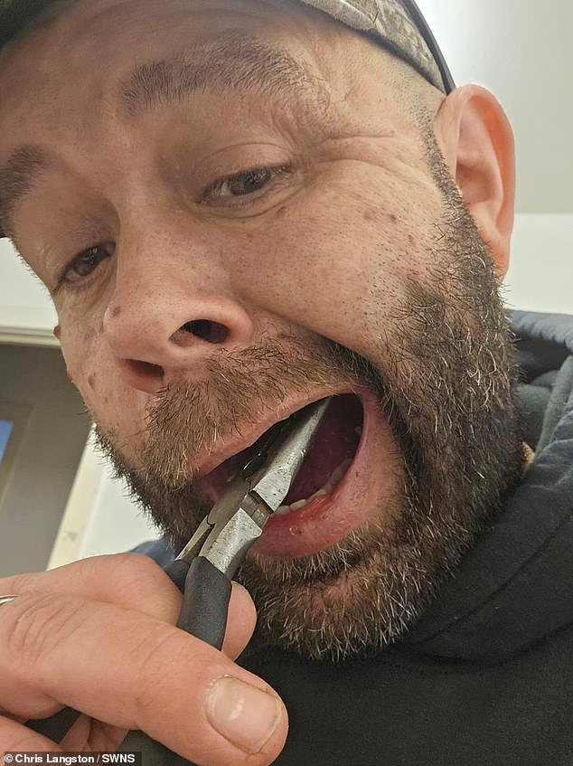 Chris Langston, 50, who organizes metal detecting holidays, removed his back molar with pliers after it became loose