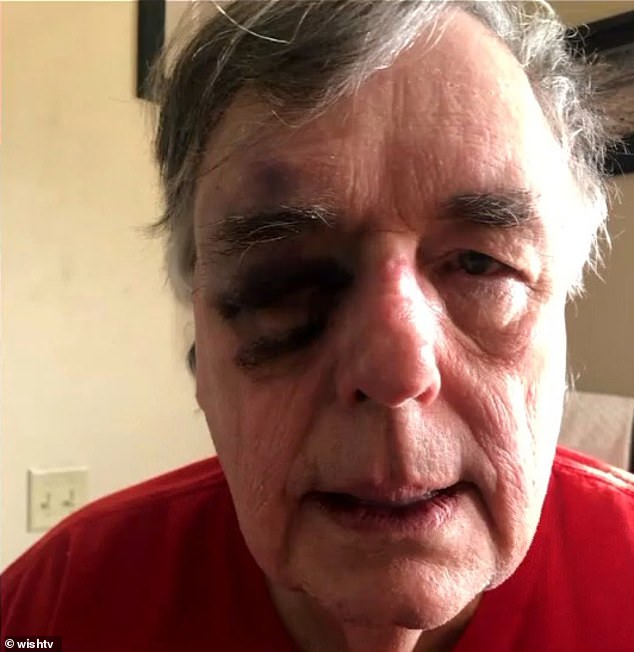 A 74-year-old substitute teacher was brutally beaten by a 6-foot-2, 280-pound student in Indiana earlier this month