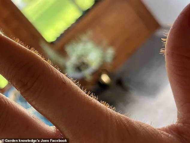 Hundreds of needle-sharp cactus spines were in Joe's hand