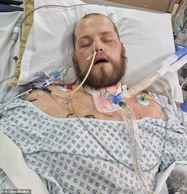 Doctors had little hope that 31-year-old Ben Wilson, who suffered a massive heart attack at home in June, would survive after paramedics had to shock him 17 times to restart his heart