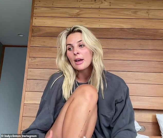 Glamorous Australian mummy blogger Indy Clinton, 27, (pictured) has documented her emotional journey after giving up her fake tan as part of a cancer charity campaign