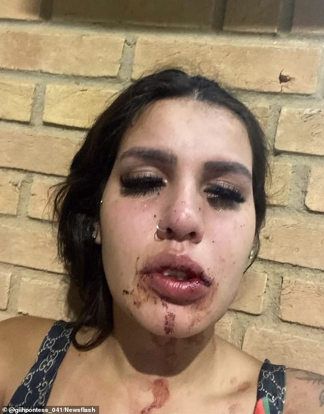 Influencer Geovana Pontes, 19, shared photos online on January 29 showing injuries (pictured) that she said were caused by the attack, and accused other social media influencers of raping and beating her – as well as a friend who was also invited