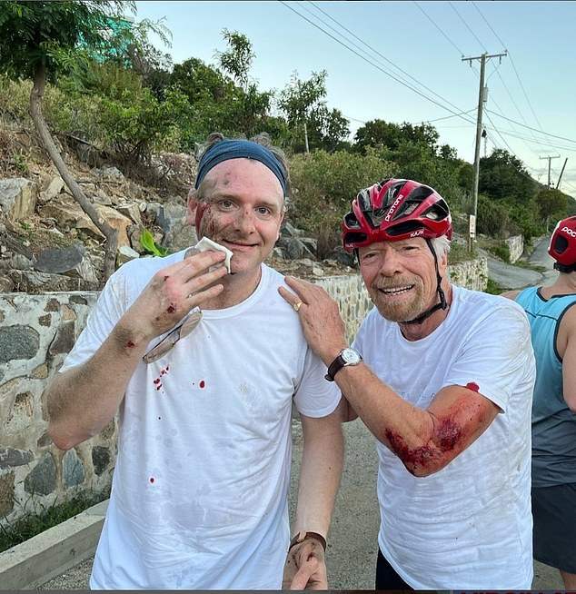 Richard Branson shared a photo of his injuries after a bicycle accident on Instagram