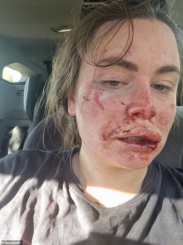 Ms Austin posted photos of herself before and after the attack by a man with a rock tied to a stick, almost a year before Samantha Murphy disappeared nearby on Sunday.