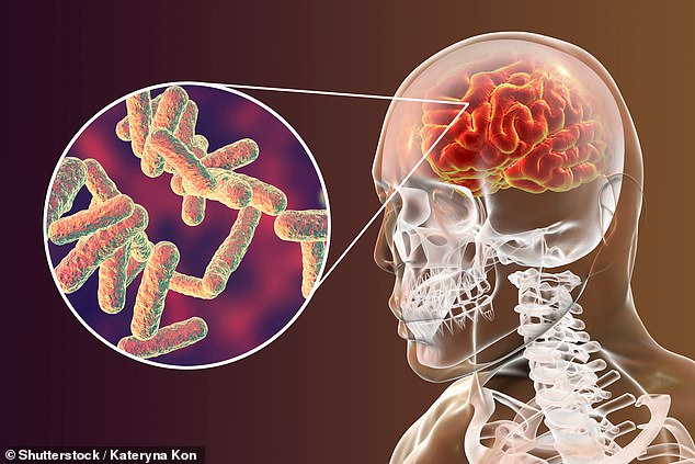 Meningitis is an infection of the protective membranes around the brain and spinal cord and can cause people to develop fever, vomiting, cold hands and feet, and a stiff neck (stock image of an illustration of meningitis-causing bacteria)