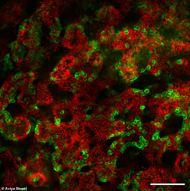These testicular organoids were grown from mouse pup cells and incubated in a dish for 21 days.  Sertoli cells (red) are responsible for the formation of the tubules in the testicle.  Germ cells (green) will produce the sperm cells.