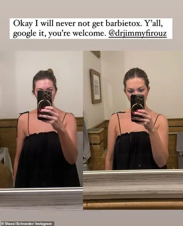 The 35-year-old reality TV personality posted before and after photos to her Instagram Stories on Thursday after undergoing the cosmetic procedure